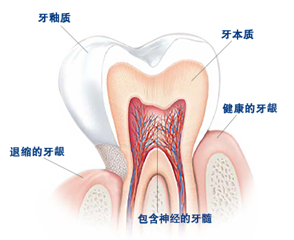 引起牙齿敏感的原因是什么？