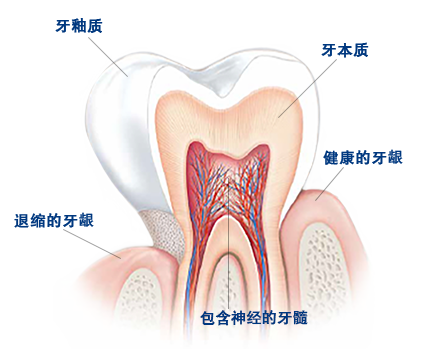 引起牙齿敏感的原因是什么? 引起牙齿敏感的原因是什么?